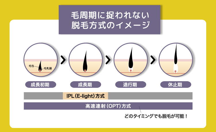 毛周期に捉われない脱毛方式のイメージ