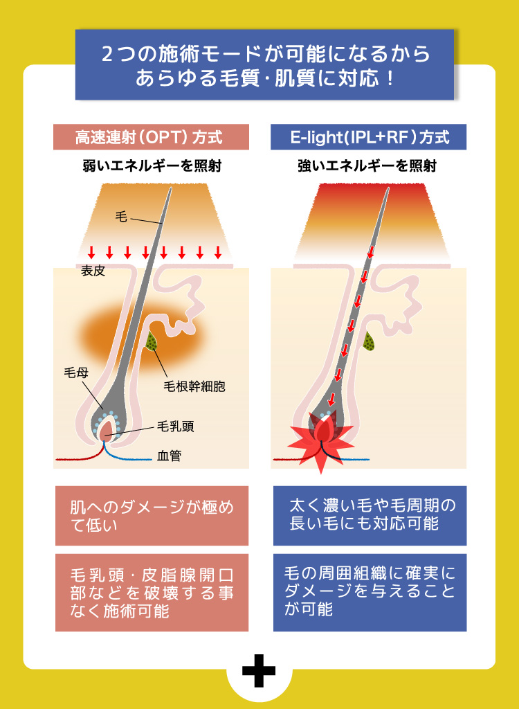 2つの施術モードが可能になるからあらゆる毛質・肌質に対応！