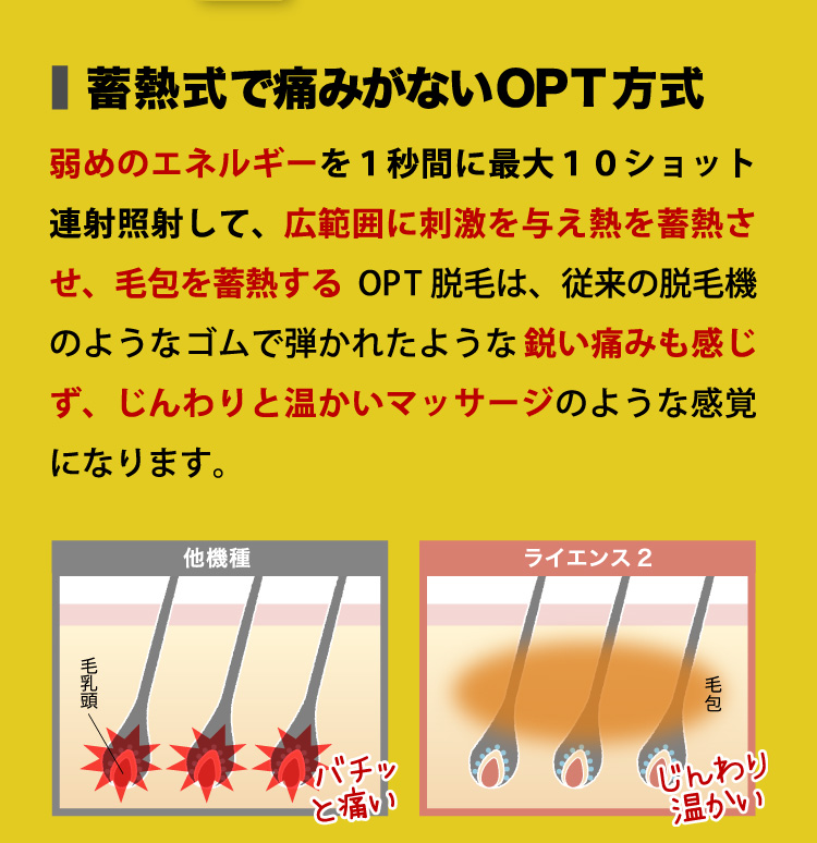 蓄熱式で痛みがないOPT方式