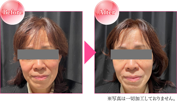 Before After